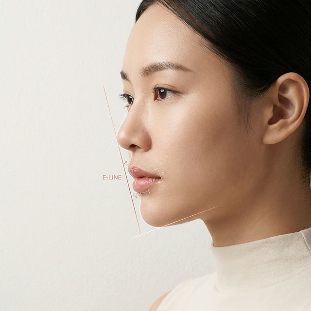 Eライン (Esthetic Line)の解説画像